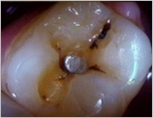 Caroline Dental